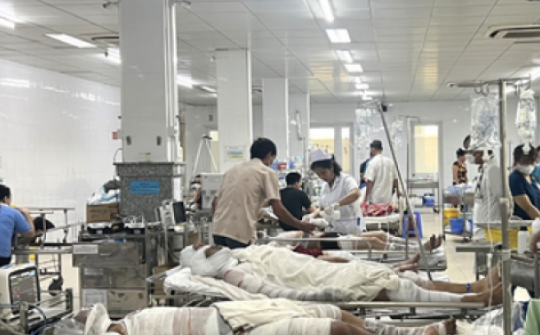 Hé lộ nguyên nhân vụ nổ ở Bình Dương làm 9 công nhân bỏng nặng