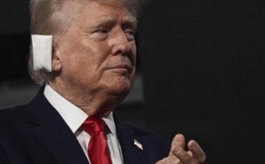 Bác sĩ tiết lộ vết thương "chảy máu rất nhiều" của ông Trump