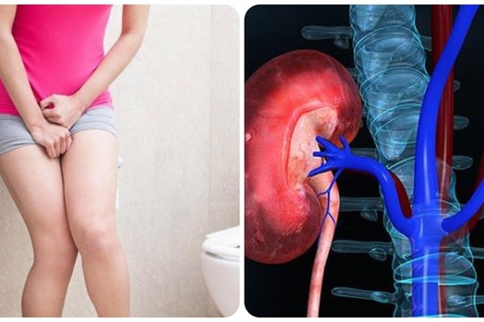 5 dấu hiệu thận đang quá tải và cần đi khám gấp