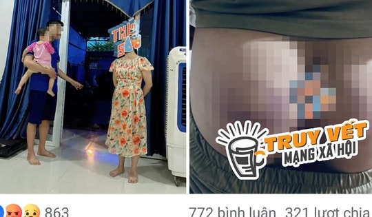 Công an xác minh thông tin cô giáo đánh học sinh bầm tím mông