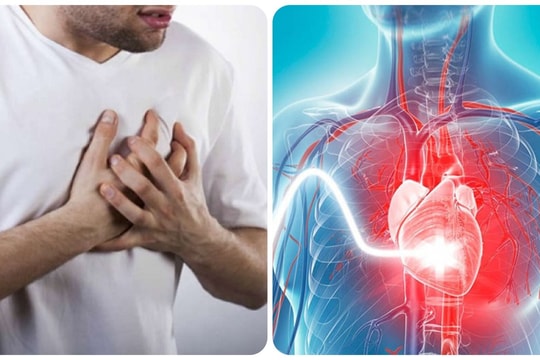 Biểu hiện truỵ tim mạch bạn không nên chủ quan