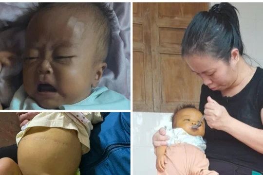 Trái tim thắt nghẹn trước nỗi đau bé 7 tháng tuổi cần ghép gan