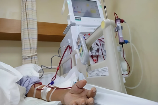 Ba vị trí thâm đen cơ thể cảnh báo suy thận