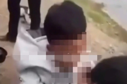 Công an xác minh vụ nam sinh bị bạn đánh, nhét băng vệ sinh vào miệng