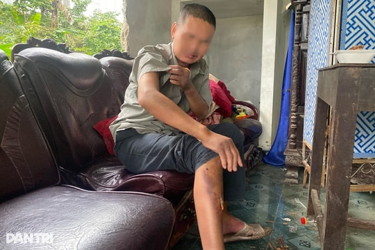 Thông tin bất ngờ về nhóm học sinh hành hạ người đàn ông ở Huế