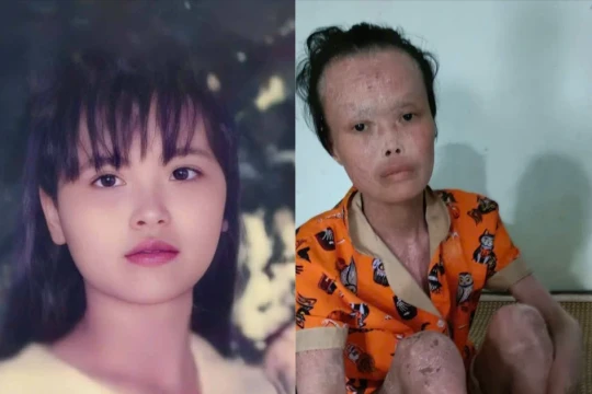 Đẫm nước mắt trước tình cảnh của cô giáo bạc mệnh