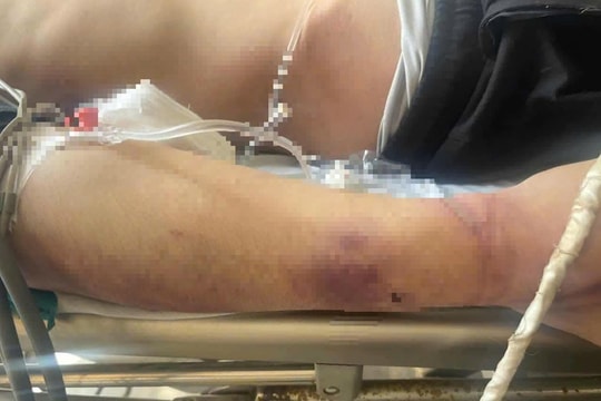 Khởi tố giám đốc Trung tâm công tác xã hội Hải Hà