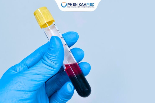 Có nên xét nghiệm NIPT từ tuần thứ 7 không? Chuyên gia Di truyền lý giải thời điểm “vàng” để sàng lọc thai nhi