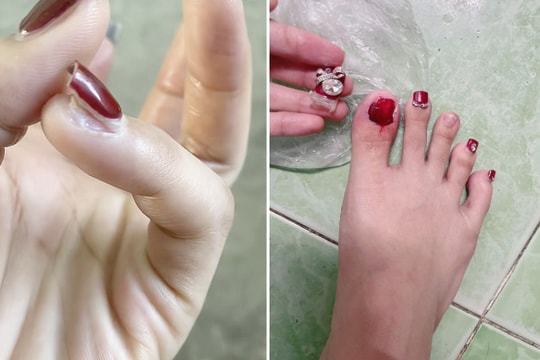 'Kiếp nạn' từ những bộ móng diện Tết