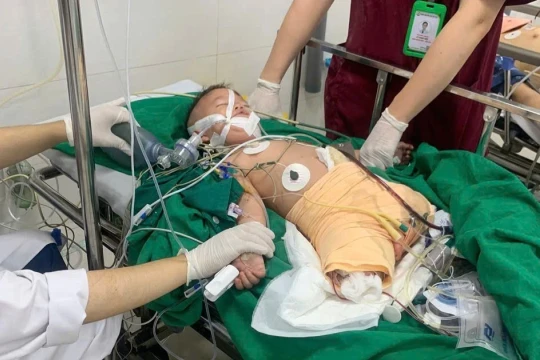 Đau xót hình ảnh bé trai 3 tuổi mất cả đôi chân sau biến cố kinh hoàng