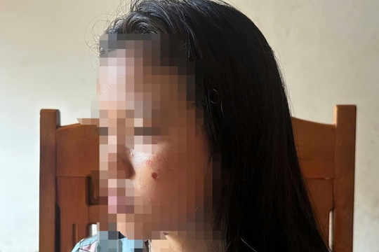 Vụ nữ sinh lớp 10 bị đánh, dí thuốc vào mặt ở Đắk Lắk: Nạn nhân không dám đi học