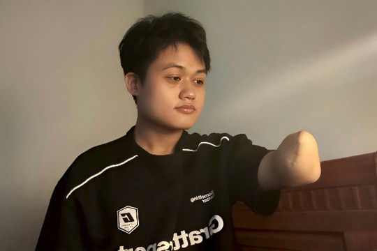 Nam sinh mất tay vì ung thư, đỗ đại học Sư phạm